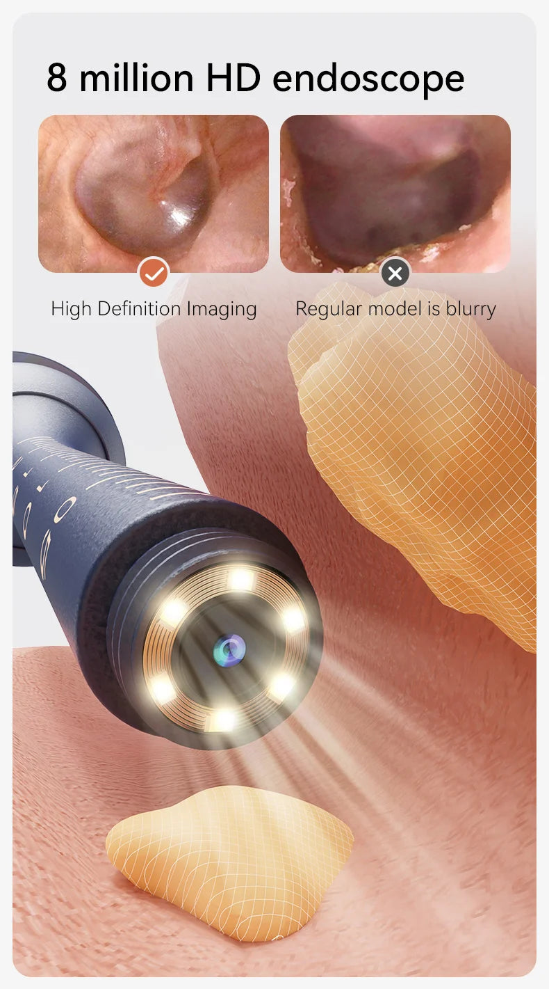 Smart Ear Wax Cleaner with Camera (HD Visual Otoscope) – Safe, Wireless, Rechargeable Ear Cleaning Kit