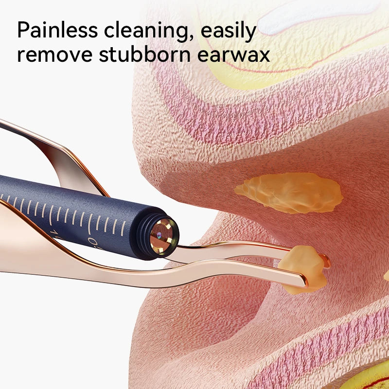 Smart Ear Wax Cleaner with Camera (HD Visual Otoscope) – Safe, Wireless, Rechargeable Ear Cleaning Kit