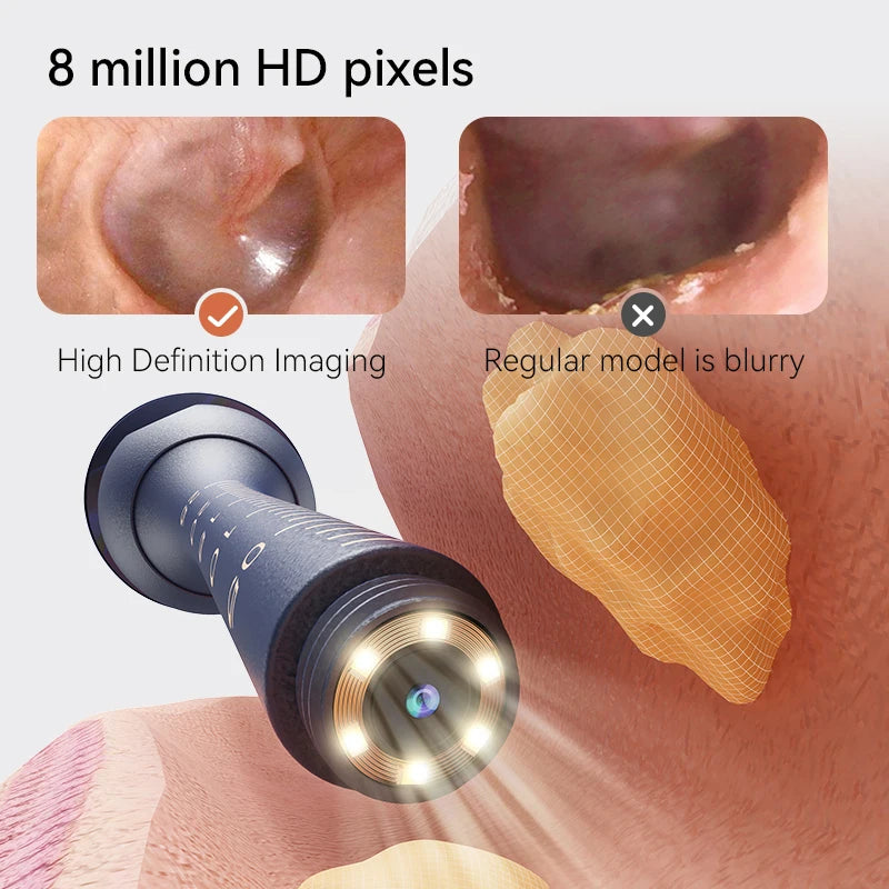 Smart Ear Wax Cleaner with Camera (HD Visual Otoscope) – Safe, Wireless, Rechargeable Ear Cleaning Kit
