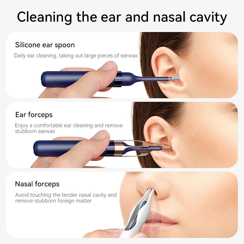 Smart Ear Wax Cleaner with Camera (HD Visual Otoscope) – Safe, Wireless, Rechargeable Ear Cleaning Kit